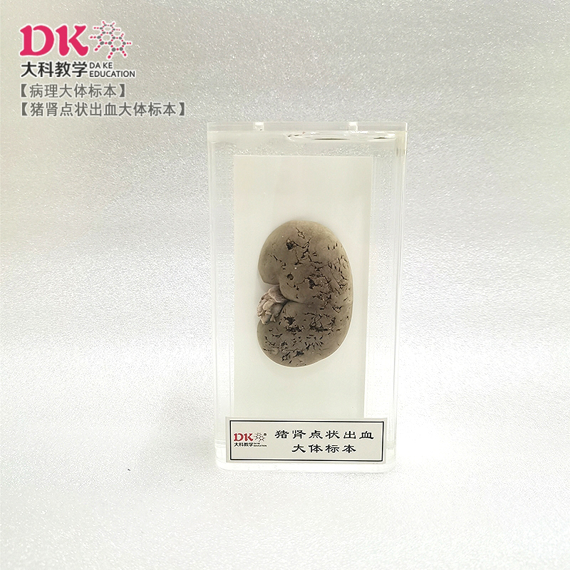 豬腎點狀出血大體標(biāo)本